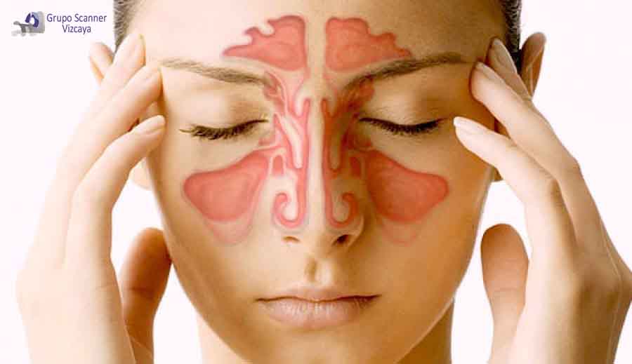 TAC senos paranasales
